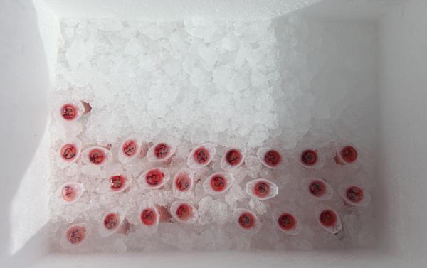 Blood samples, CCRP © Koen Vanmechelen